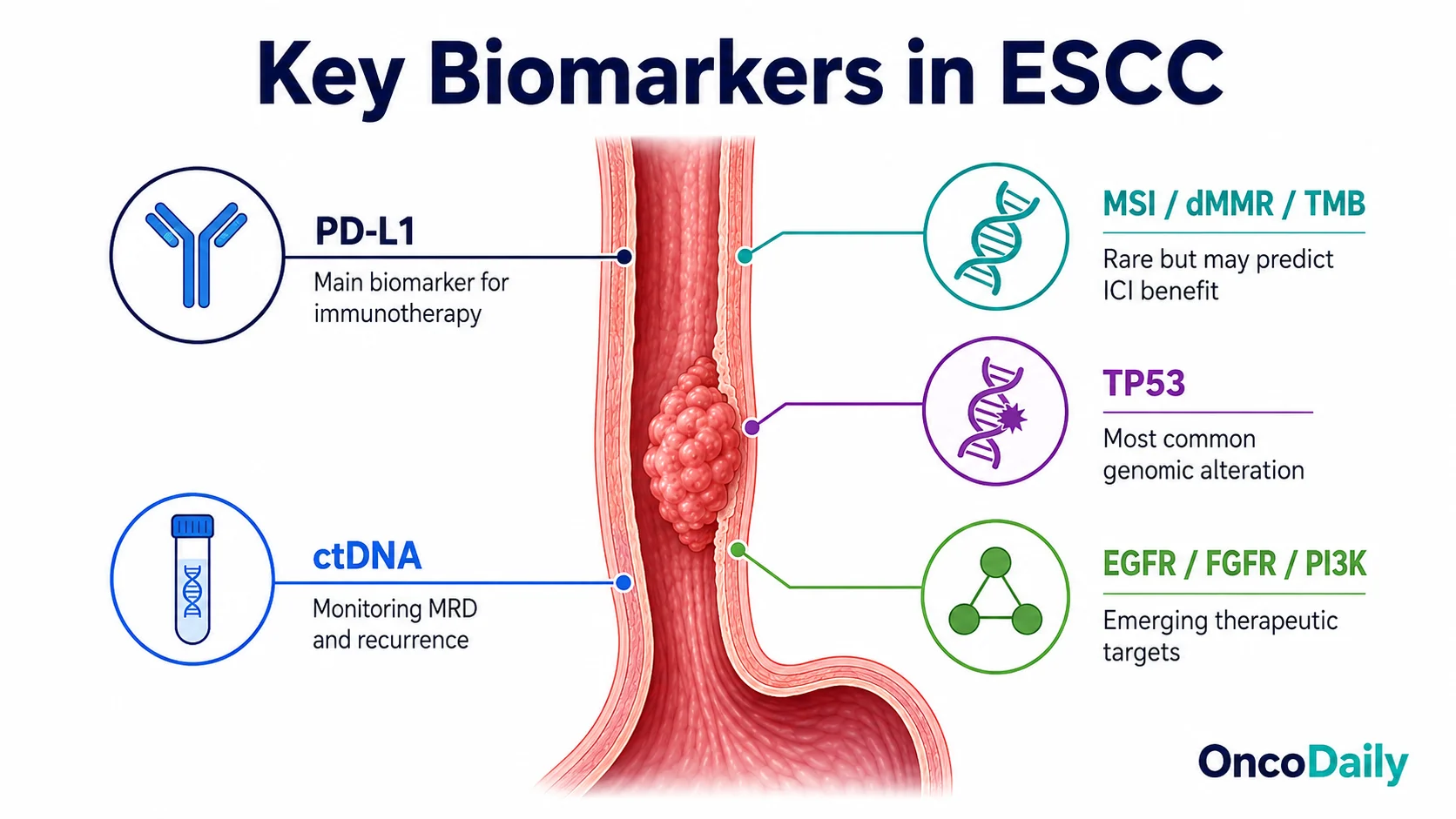 Esophageal Squamous Cell Carcinoma Biomarkers: PD-L1, Molecular Features and Emerging Targets