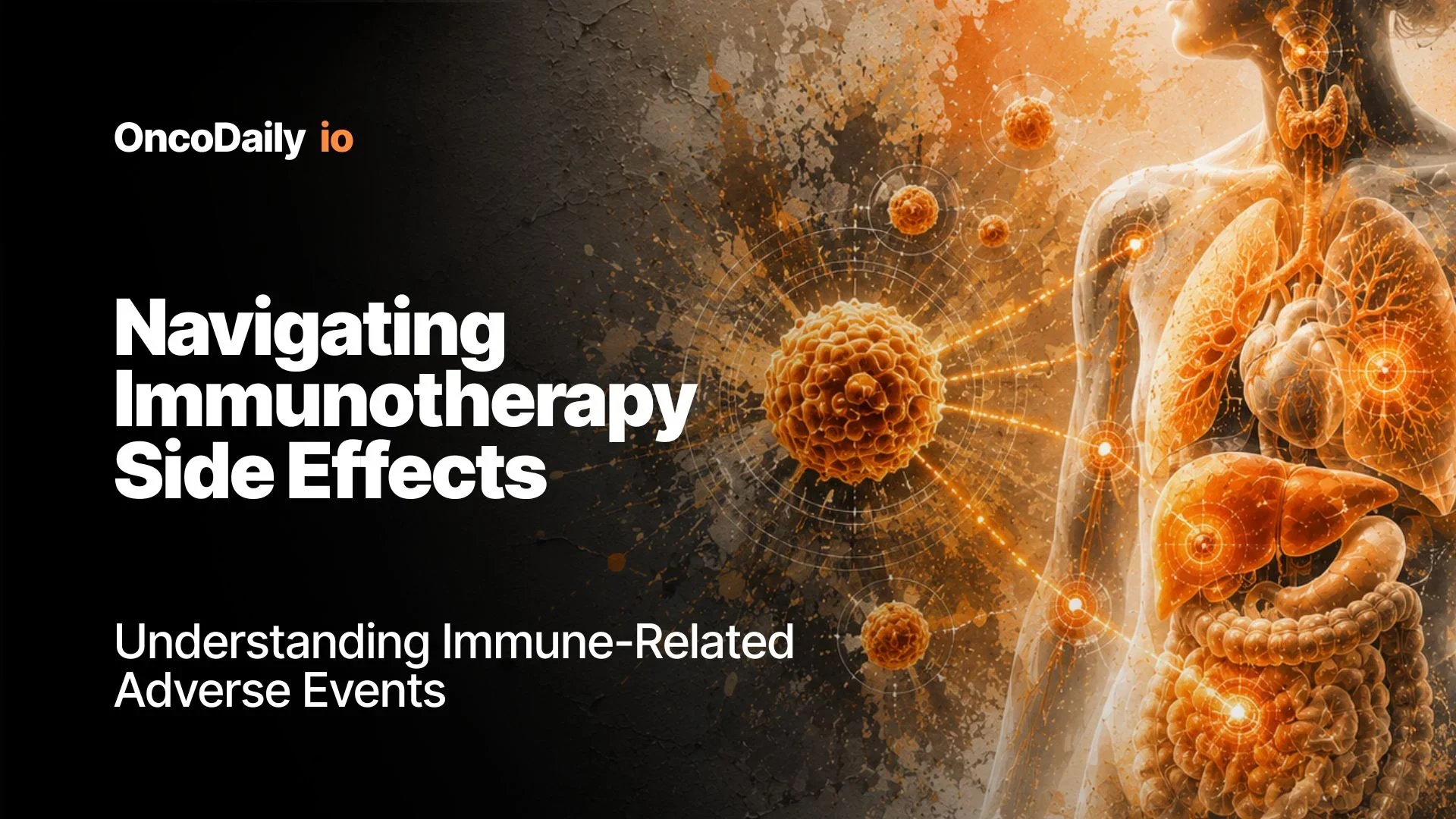 The Big Questions in Cancer Immunotherapy: Can We Treat Toxicity Without Losing Antitumor Immunity?