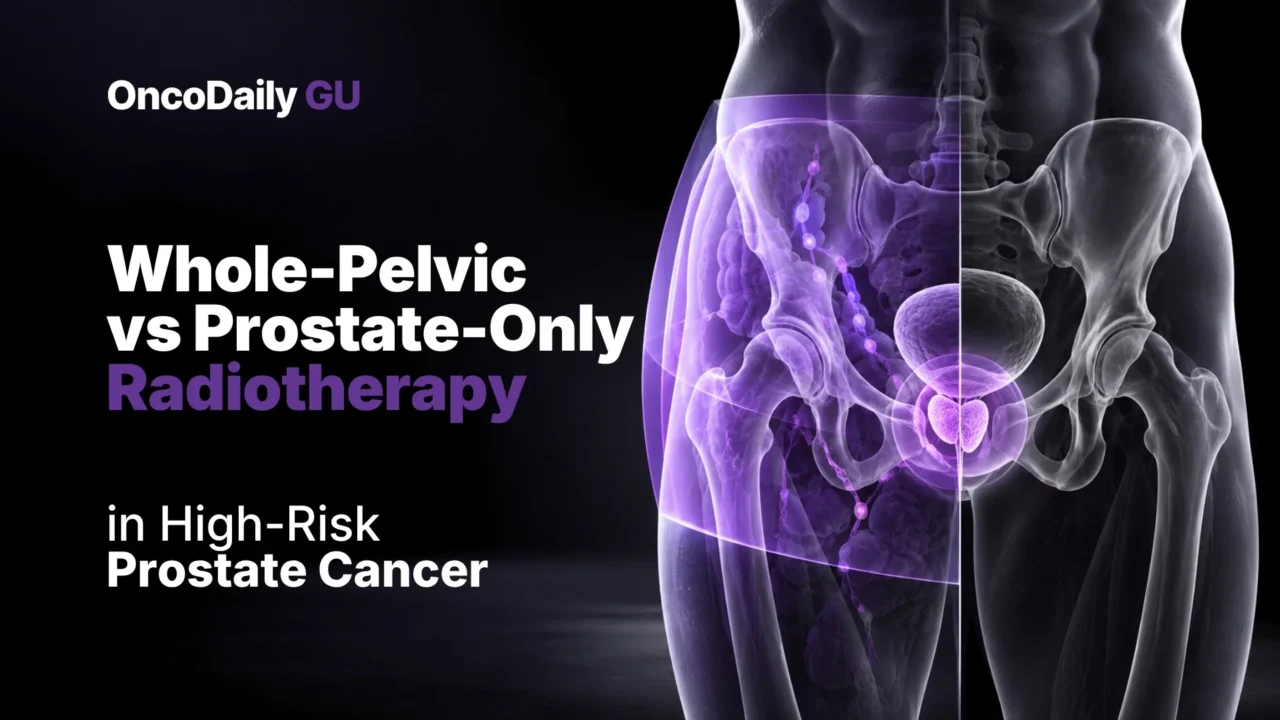 Whole-Pelvic vs Prostate-Only Radiotherapy in High-Risk Prostate Cancer