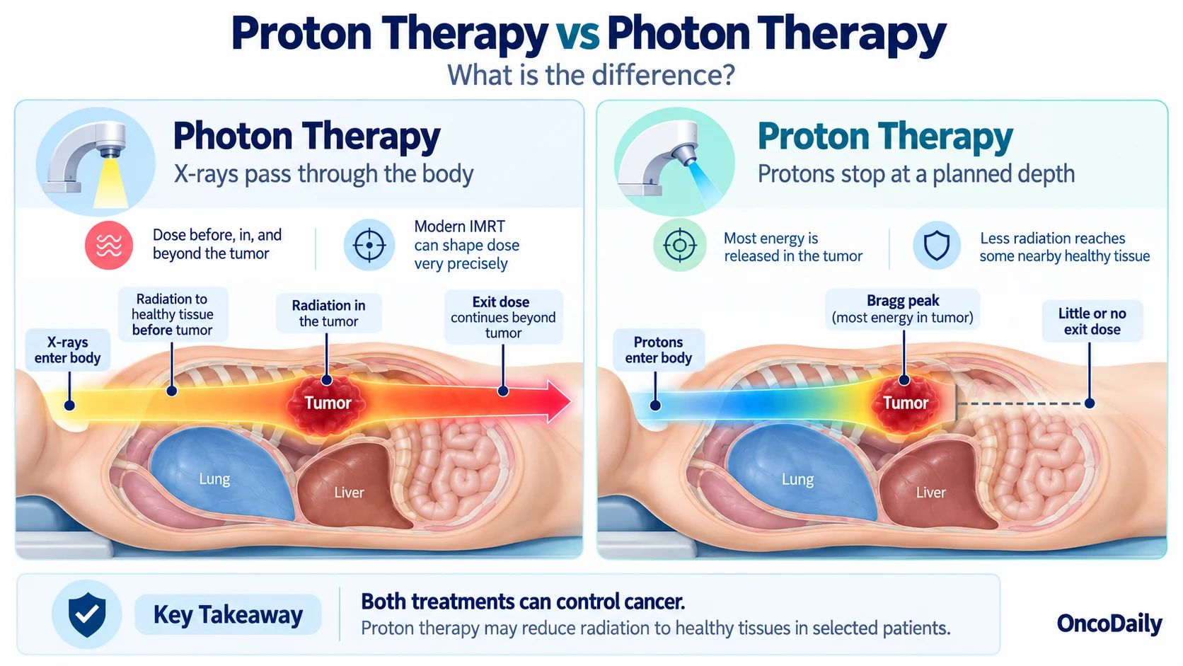 Proton Therapy vs Photon Therapy: Differences, Benefits, and Side Effects 2 Proton Therapy vs Photon Therapy: Differences, Benefits, and Side Effects