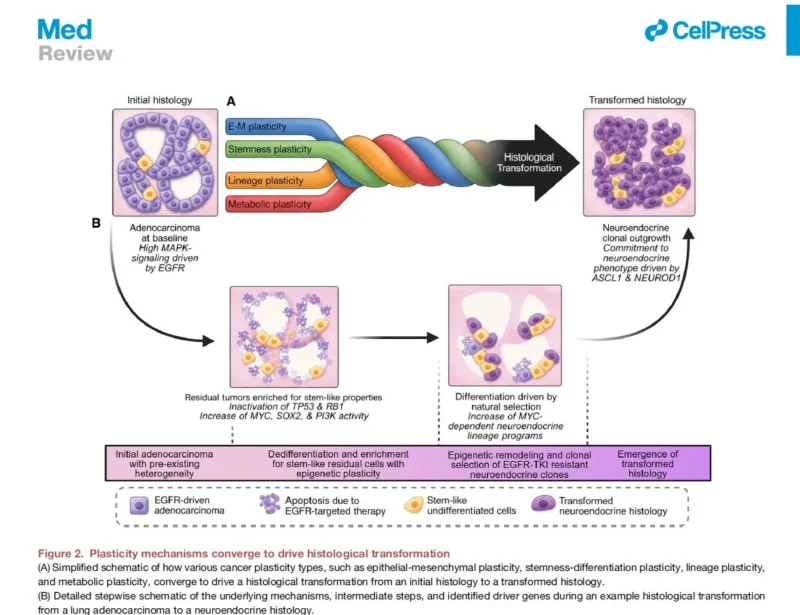 Vivek Subbiah: How Tumor Plasticity Drives Resistance to Precision Cancer Therapies? 2 Vivek Subbiah: How Tumor Plasticity Drives Resistance to Precision Cancer Therapies?