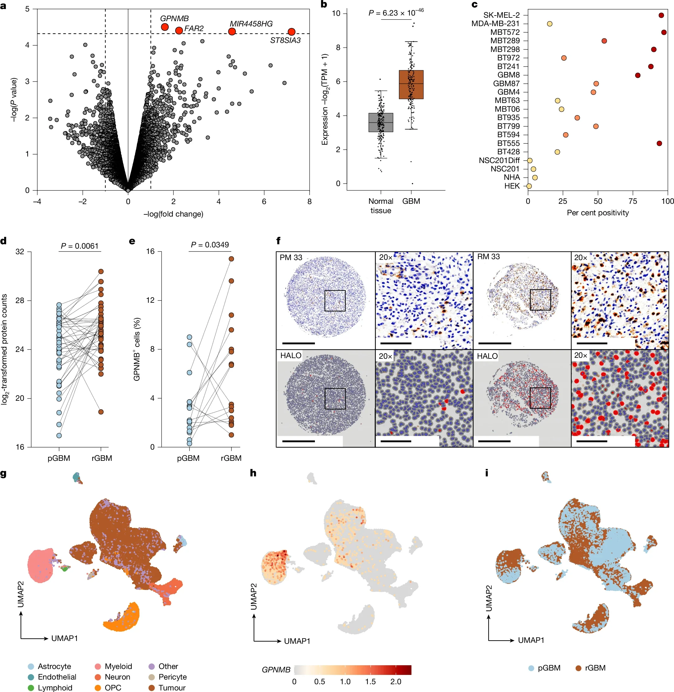GPNMB CAR-T: Targeting Glioblastoma and Its Immune Microenvironment