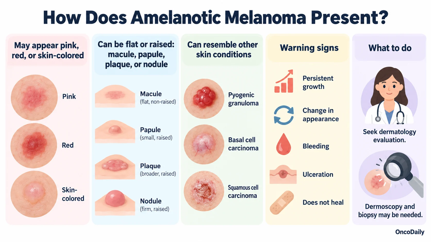 Amelanotic Melanoma: The Skin Cancer That Can Be Easy to Miss 2 Amelanotic Melanoma: The Skin Cancer That Can Be Easy to Miss