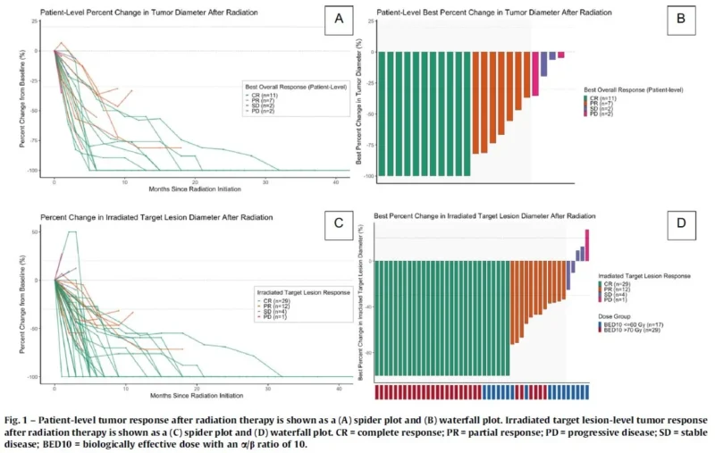 Pavlos Msaouel։ Study Reports High Response Rates to Metastasis-Directed Radiation Therapy in SMARCB1-Deficient RMC 2 Pavlos Msaouel