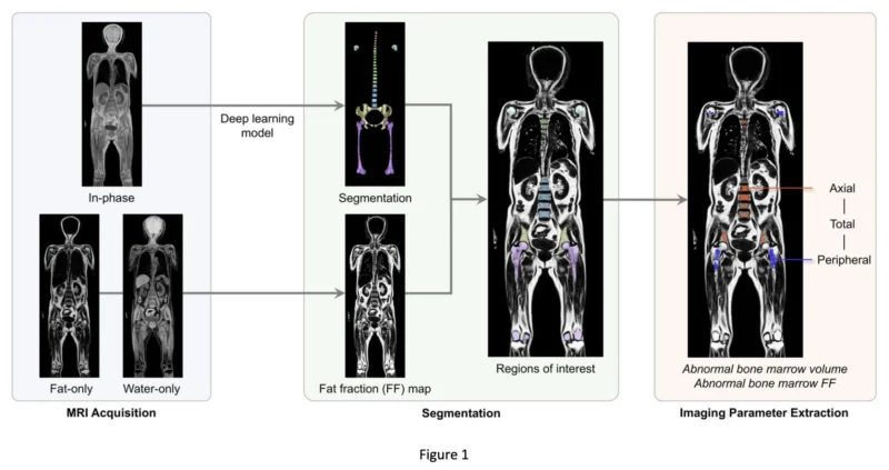 Myeloma Paper of the Day, October 26th, Suggested by Robert Orlowski