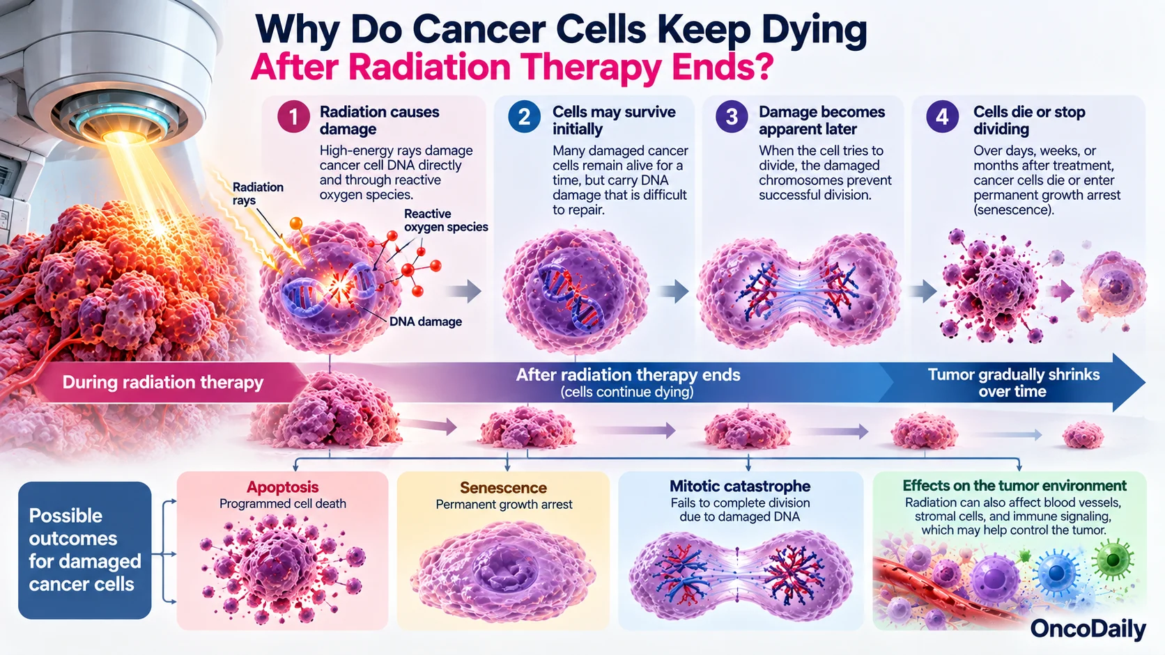 How Radiation Therapy Kills Cancer Cells: When Does It Start Working?