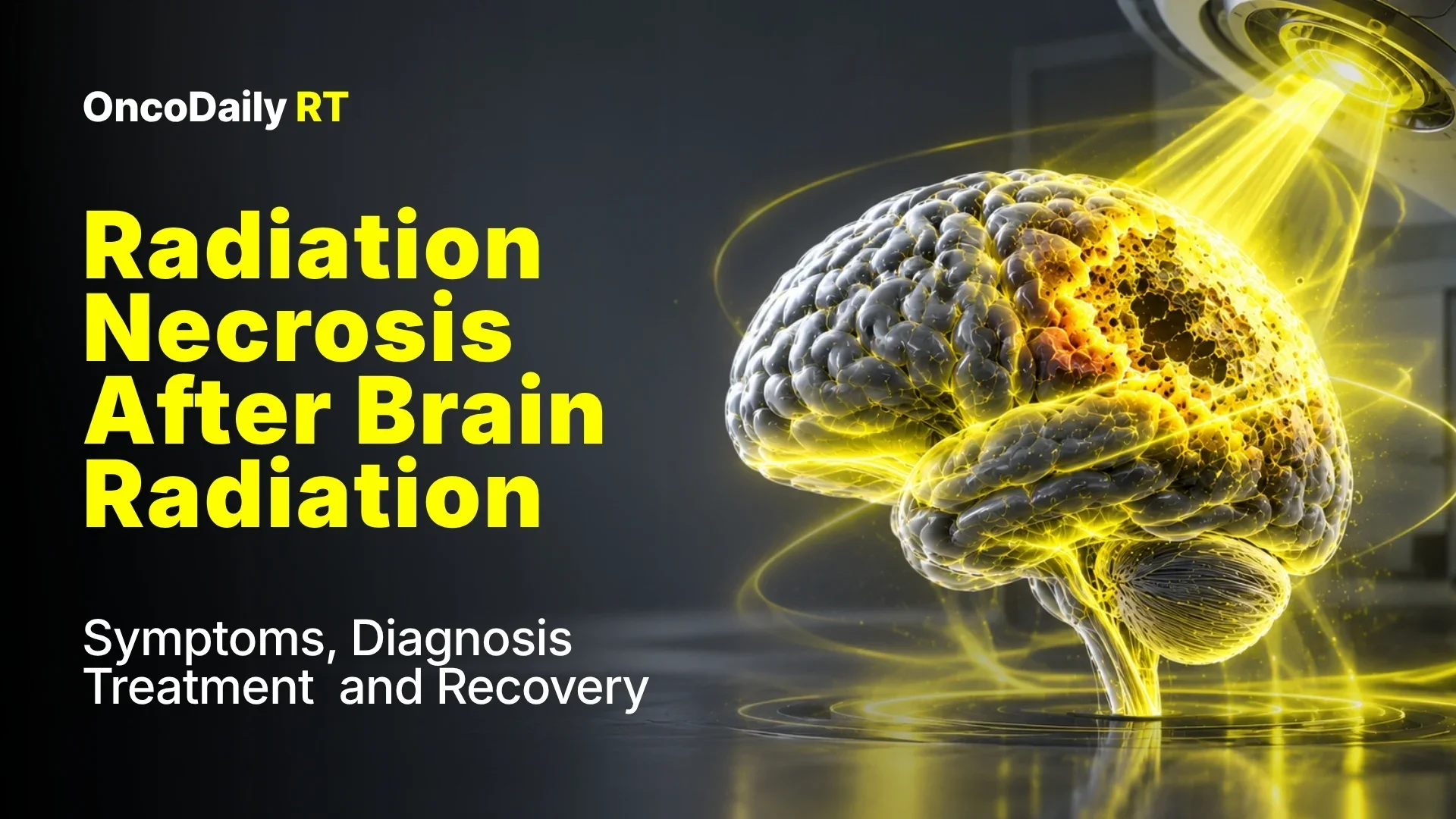 The Role of Family Caregivers in Recognizing Changes After Radiation for Glioblastoma - WeTrials