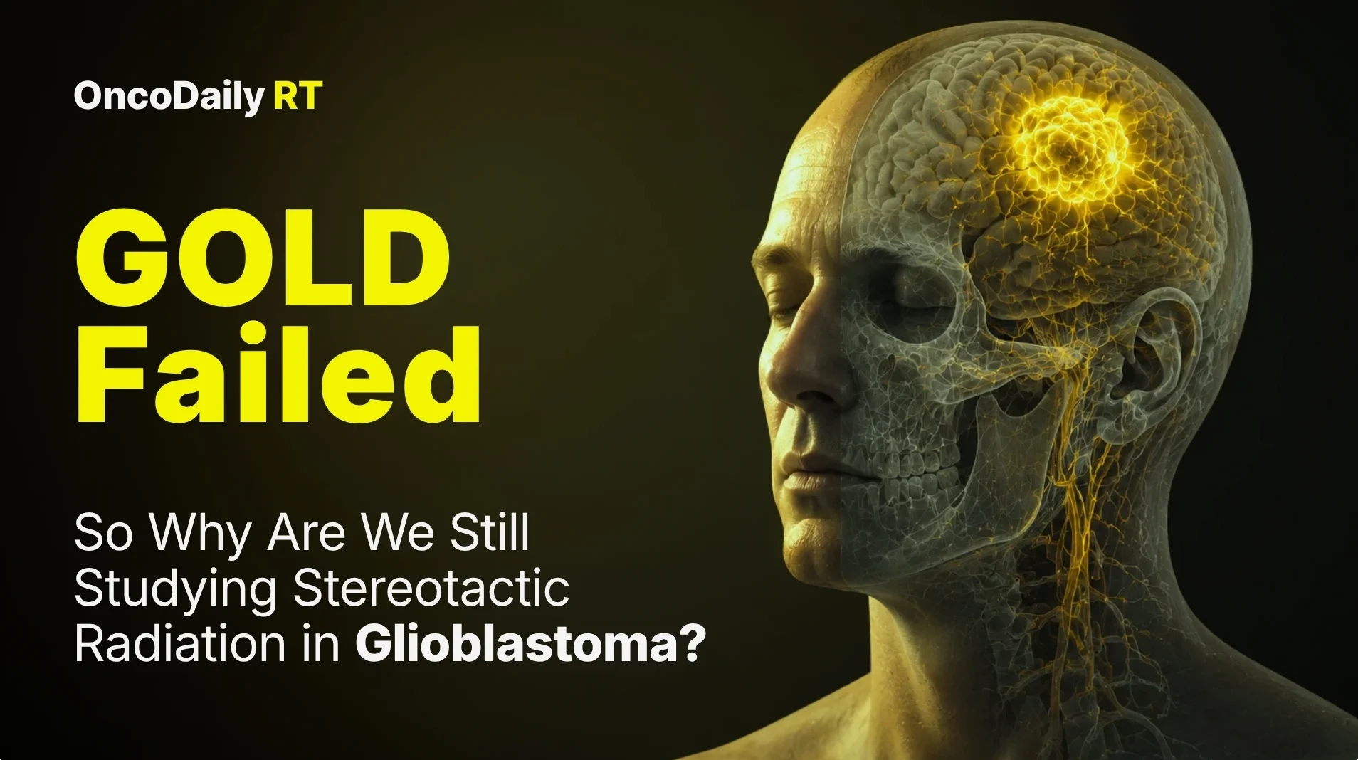 radiation therapy