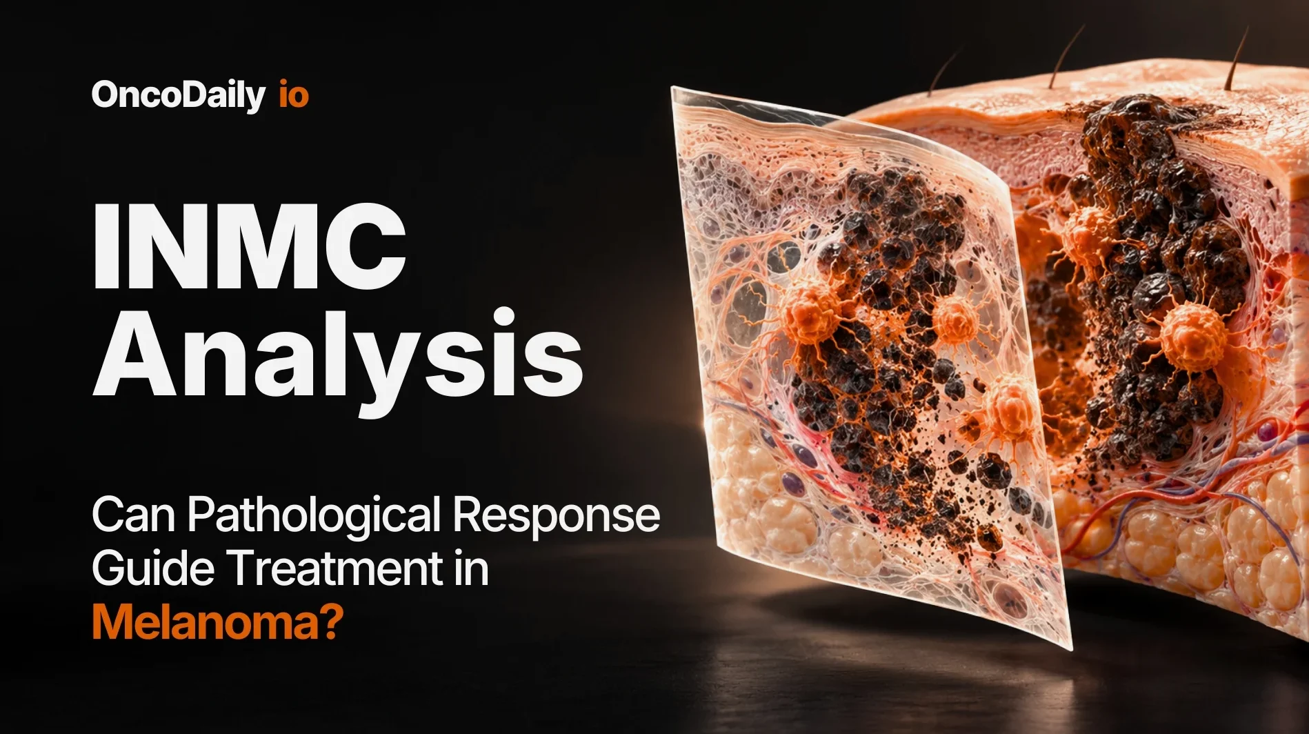 Amelanotic Melanoma: The Skin Cancer That Can Be Easy to Miss 4 Amelanotic Melanoma: The Skin Cancer That Can Be Easy to Miss