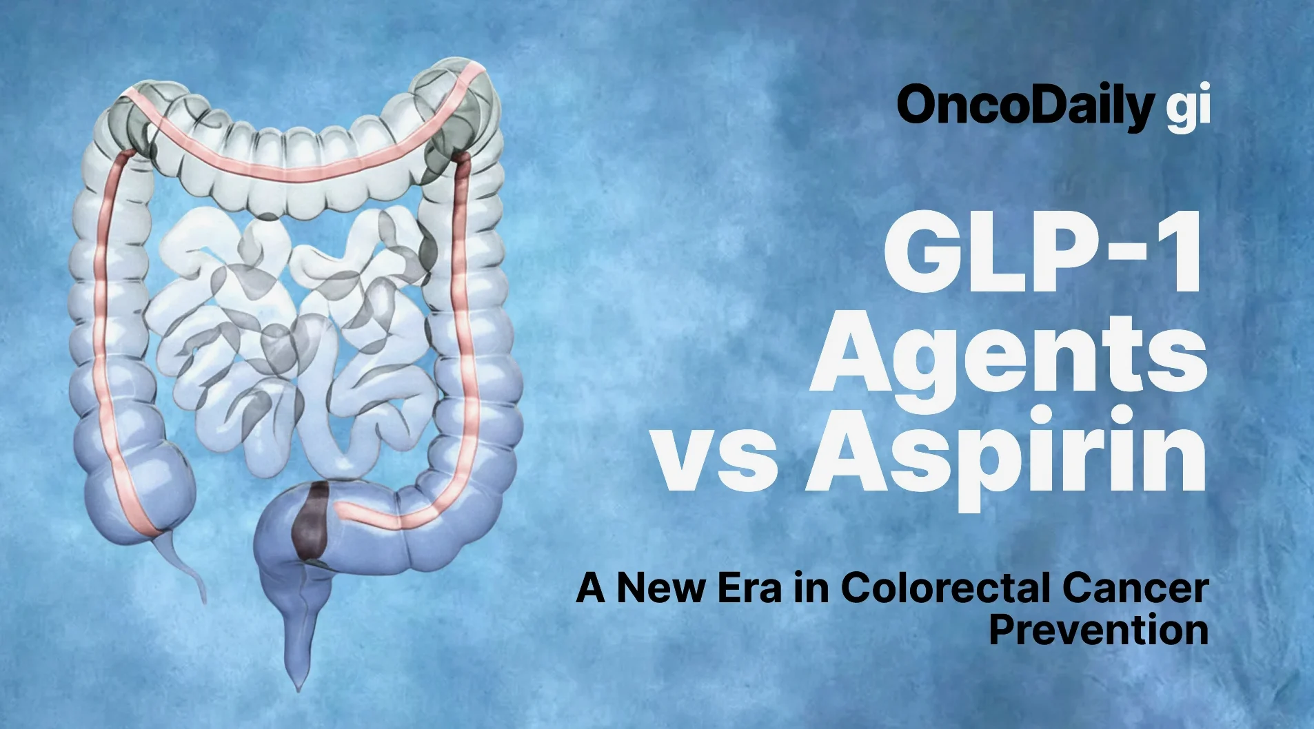 GLP-1 and cancer