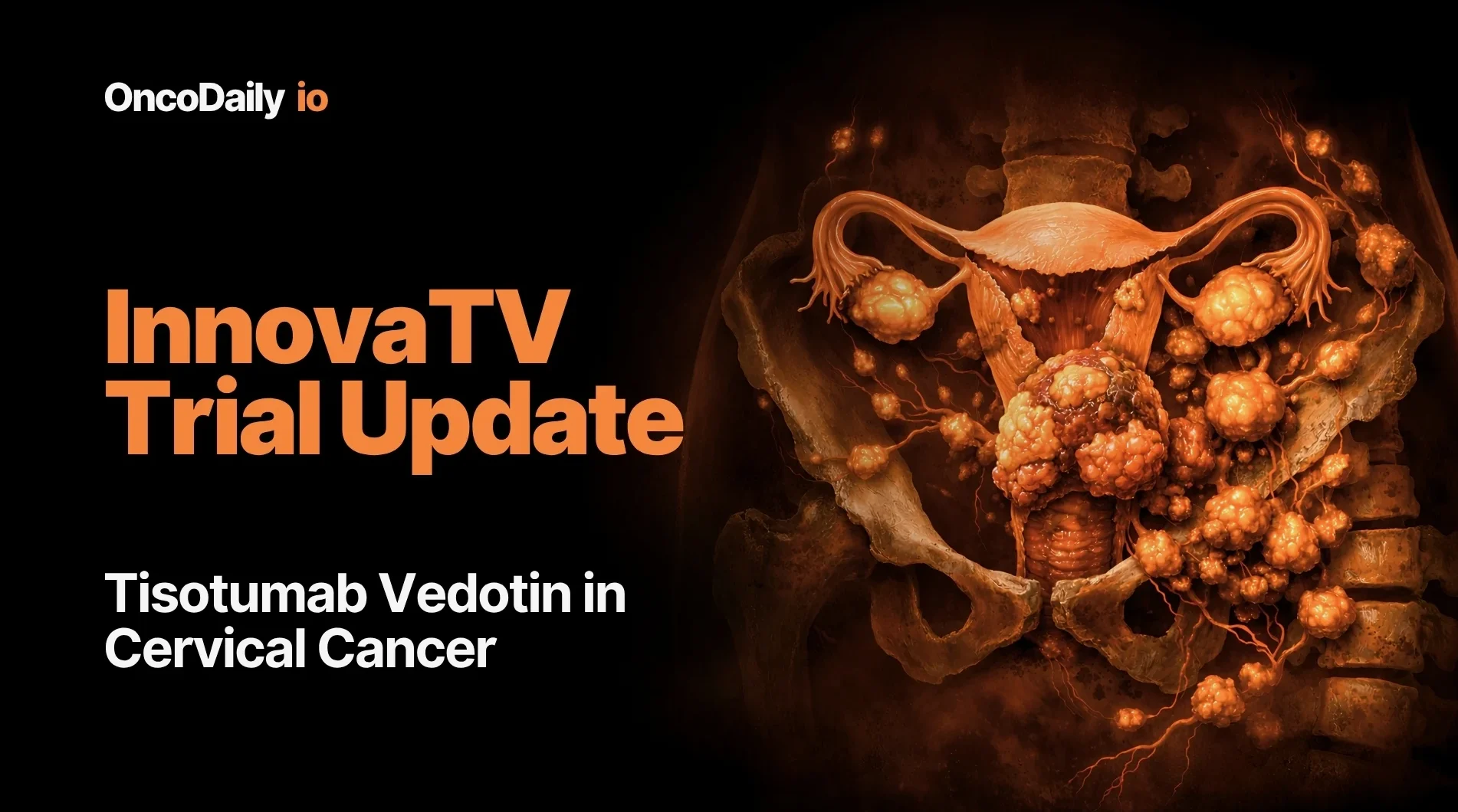 SHR-A2102 at ESMO 2026 Shows 47.2% Response Rate in Recurrent or Metastatic Cervical Cancer 2 SHR-A2102