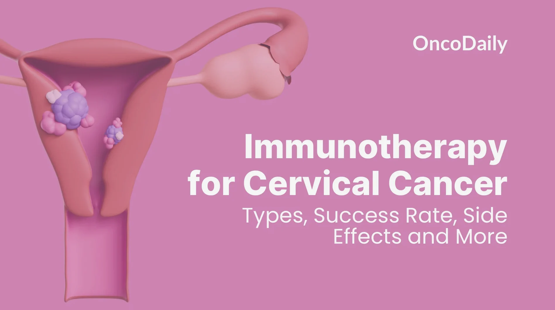 JSKN033 at ESMO 2026: Shows 52.9% Response Rate in Pretreated Cervical Cancer 2 JSKN033 at ESMO 2026: Shows 52.9% Response Rate in Pretreated Cervical Cancer