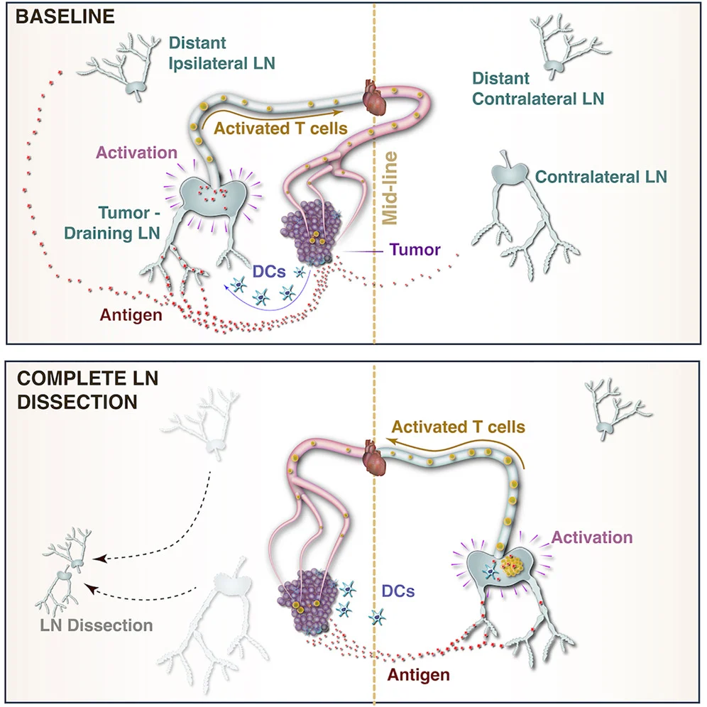 Can Distant Lymph Nodes Sustain Immunotherapy After Lymph-Node Surgery? 2 Distant Lymph Nodes