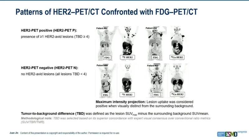 PREDICT-HER: HER2-PET Identifies T-DXd Resistance Beyond Conventional HER2 Pathology 4 PREDICT-HER