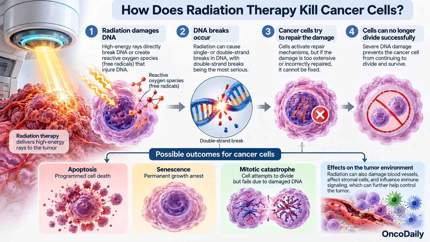 How Radiation Therapy Kills Cancer Cells: When Does It Start Working?
